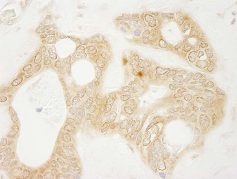 Polyclonal Rabbit anti-Human PARP4 / VPARP Antibody (aa1674-1724, IHC)