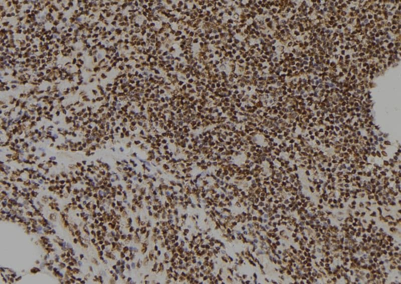 Polyclonal Rabbit anti-Human ZNF227 Antibody (IHC, WB)