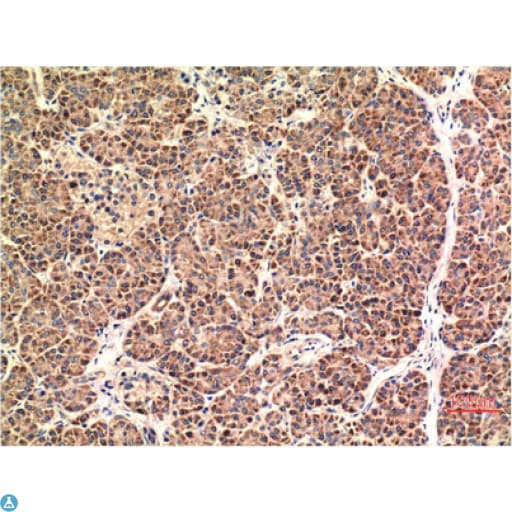 Monoclonal Mouse anti-Human DDIT3 / CHOP Antibody (IHC)