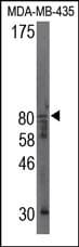 CAPN9 / Calpain 9 Antibody