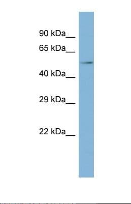 TCTE1 Antibody (aa336-385)