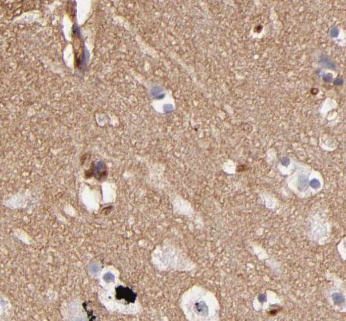Polyclonal Rabbit anti-Human ABCB1 / MDR1 / P Glycoprotein Antibody (IHC, WB)