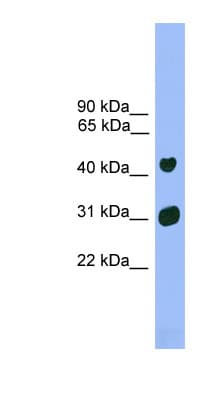 LHX5 Antibody (aa251-300)