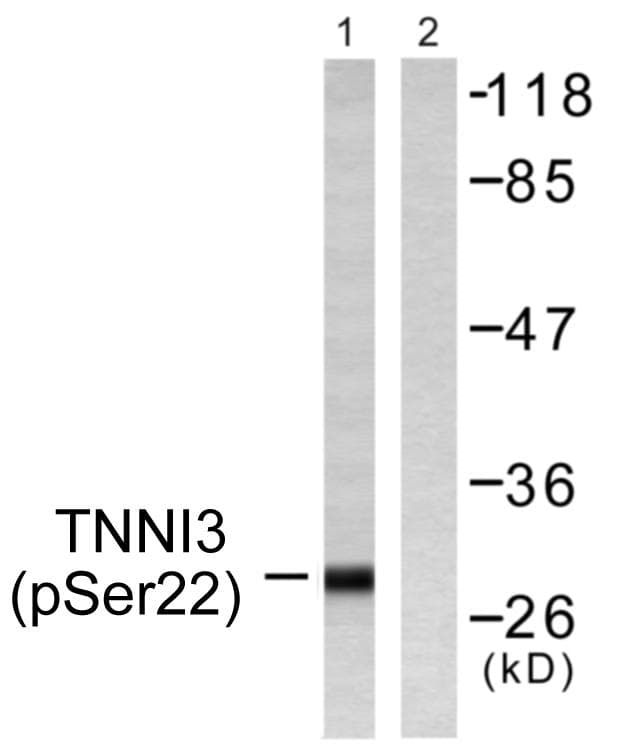 TNNI3 / Cardiac Troponin I Antibody (phospho-Ser22+Ser23)