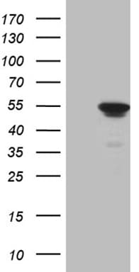 ELP4 Antibody (aa133-407, clone OTI3A4, Carrier-free)