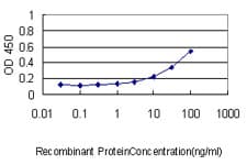 Monoclonal Mouse anti-Human DNM1L / DRP1 Antibody (clone 3B5, IHC, WB)