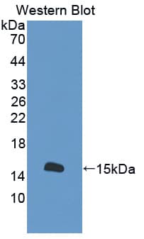 S100A16 Antibody (aa1-97, PE)