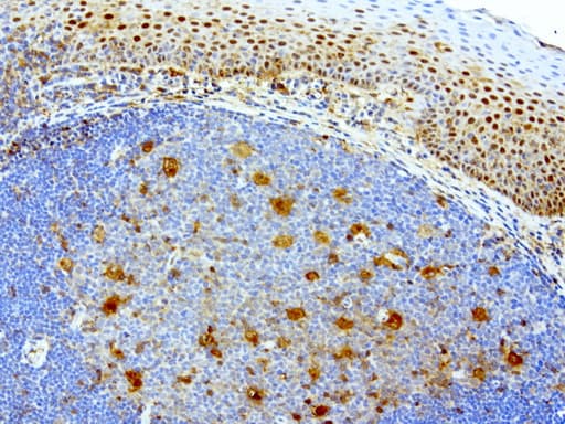Monoclonal Mouse anti-Human TP / Thymidine Phosphorylase Antibody (clone UMAB90, aa311-482, IHC, WB)