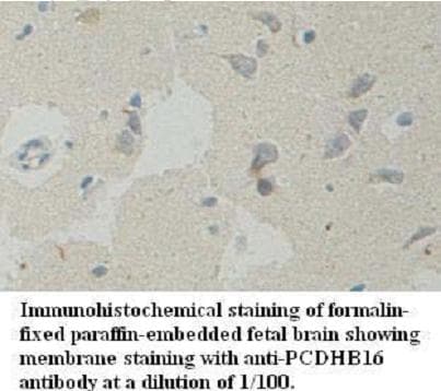 PCDHB16 Antibody (aa199-458)