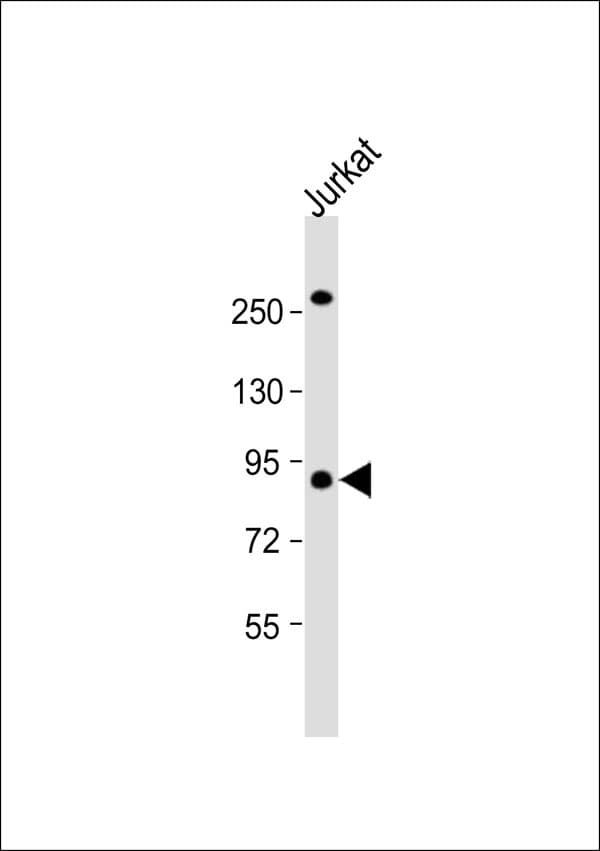 LTK Antibody