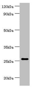 Polyclonal Rabbit anti-Human TNFSF13 / APRIL Antibody (aa105-247, IHC, WB)