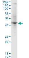 RNF2 / RING2 / RING1B Antibody (clone 3G6)