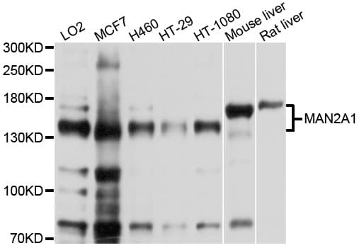 IHC-plus™ MAN2A1 / Mannosidase II Antibody (aa865-1144)