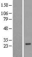 ZNF747 Protein (Over-Expression Lysate Myc-DDK (Flag))