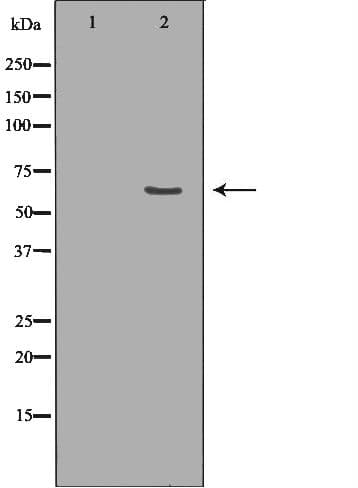 Polyclonal Rabbit anti-Human FAAH Antibody (IHC, WB)