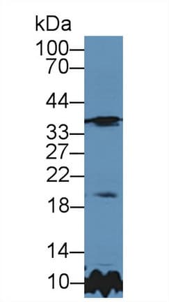TIMP3 Antibody (aa27-209, Biotin)