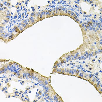 SKAP2 / SCAP2 Antibody