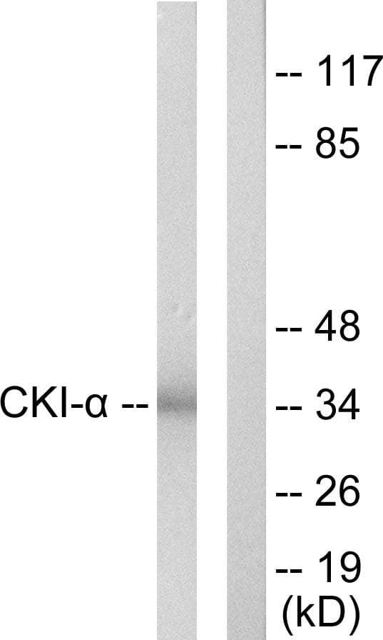 CSNK1A1 / CK1 Alpha Antibody