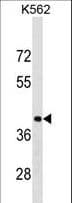 HnRNP-E1 / PCBP1 Antibody (aa188-217)