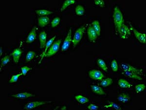 GTPBP4 Antibody