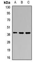 Polyclonal Rabbit anti-Human PTCRA Antibody (WB)