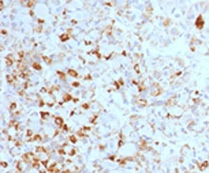 LHB / Luteinizing Hormone Antibody (clone LHb/1214)
