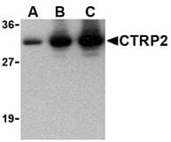 C1QTNF2 / CTRP2 Antibody