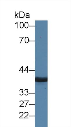 Mannose Phosphate Isomerase Antibody (aa2-423, PE)