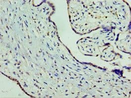 SLC25A15 / ORNT1 Antibody (aa1-301)