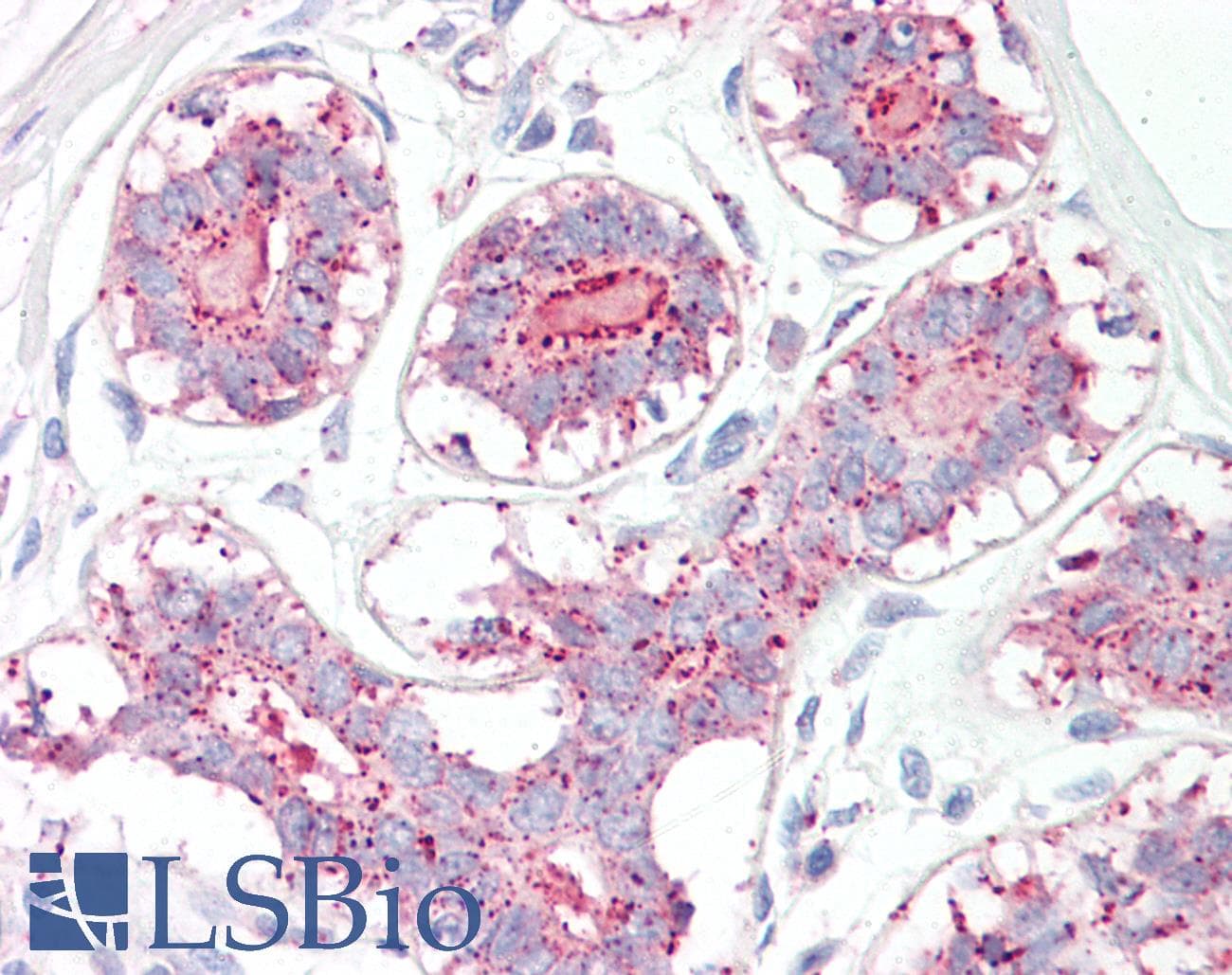 Polyclonal Rabbit anti-Human MAGEA1 / MAGE 1 Antibody (aa38-87, IHC, WB)