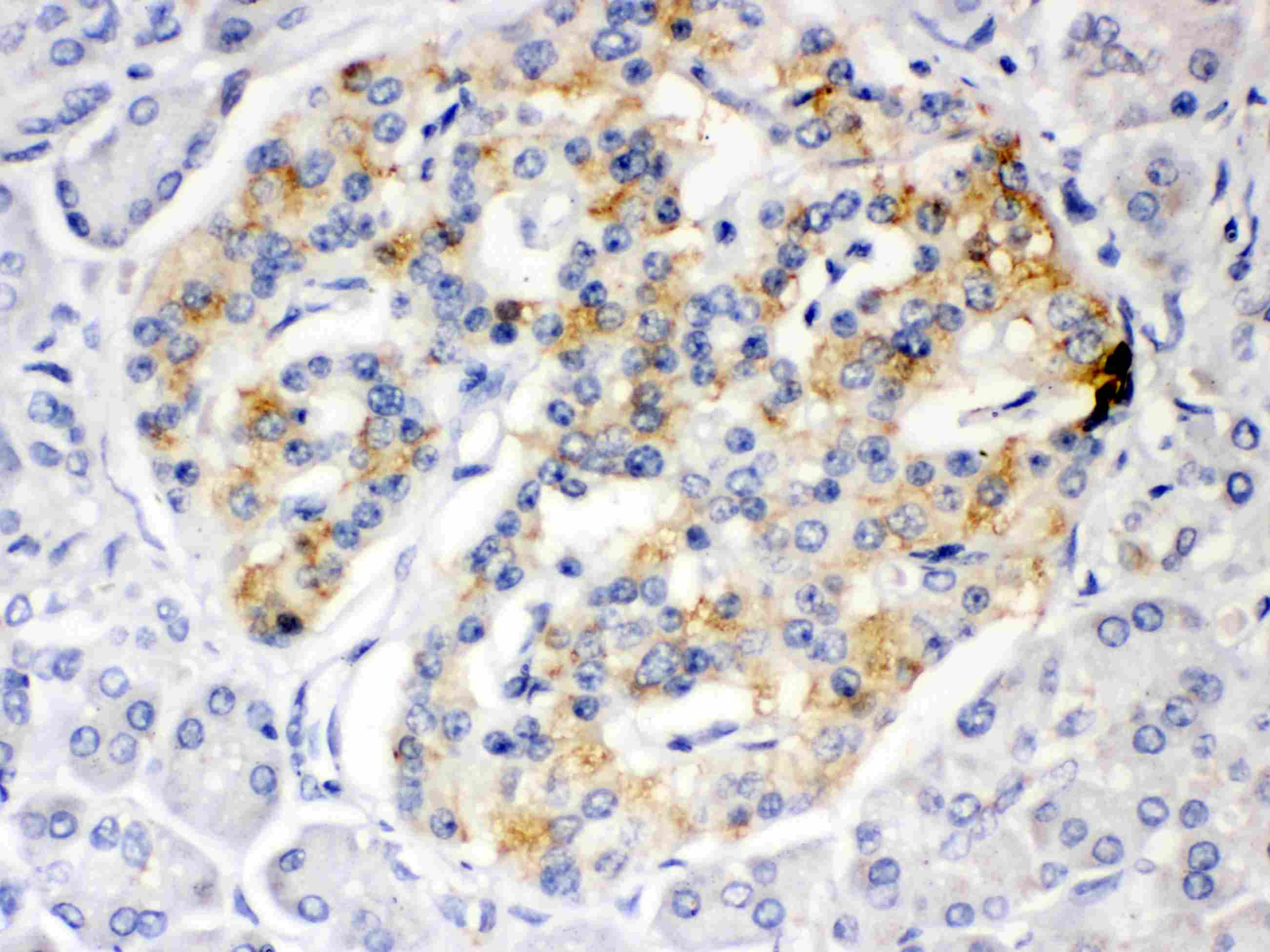 Polyclonal Rabbit anti-Human ISG15 Antibody (IHC, WB)