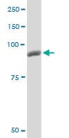IHC-plus™ PYGM Antibody (clone 2C4)