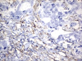 Monoclonal Mouse anti-Human Vimentin Antibody (clone OTI5D7, IHC, WB)