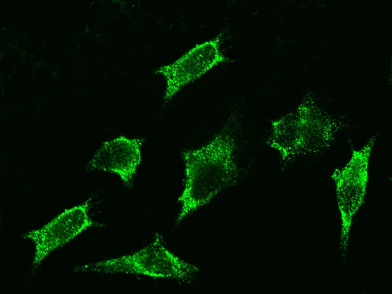Polyclonal Rabbit anti-Human ADRB2 Antibody (Preservative Free, IHC, IF)