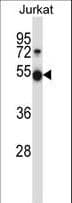 PIM1 / Pim-1 Antibody (aa343-372)