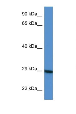 Polyclonal Rabbit anti-Human LYG2 Antibody (aa99-148, WB)