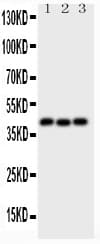 Polyclonal Rabbit anti-Human WNT5A Antibody (aa184-303, WB)
