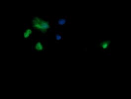 IHC-plus™ SAE1 Antibody (clone 1G8)