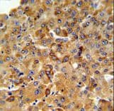 Polyclonal Rabbit anti-Human SFT2D3 Antibody (aa14-42, IHC, WB)