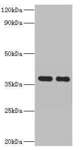 GALM / Mutarotase Antibody