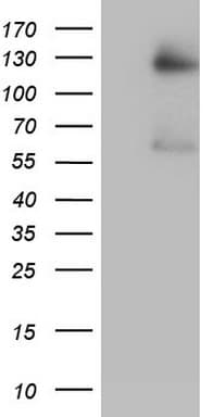 GLI / GLI1 Antibody (aa755-1106, clone OTI1A8)