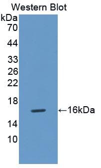 FABP4 / AP2 Antibody