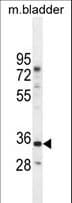Polyclonal Rabbit anti-Human C17orf59 Antibody (aa186-215, WB)