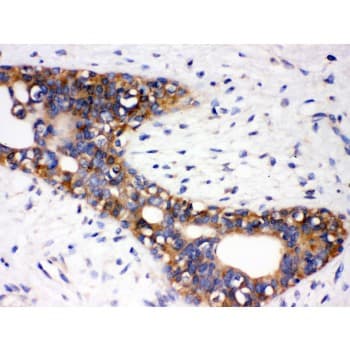 Polyclonal Rabbit anti-Human AGTR1 / AT1 Receptor Antibody (aa1-28, IHC, WB)