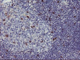 RBPMS / Hermes Antibody (clone OTI3B7)