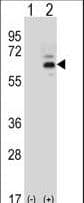 Polyclonal Rabbit anti-Human FASTK / FAST Antibody (aa395-424, IHC, WB)