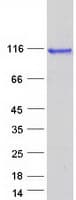 Human DIS3L2 Protein (Recombinant Myc-DDK (Flag))