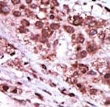 GSK3B / GSK3 Beta Antibody (aa4-34)