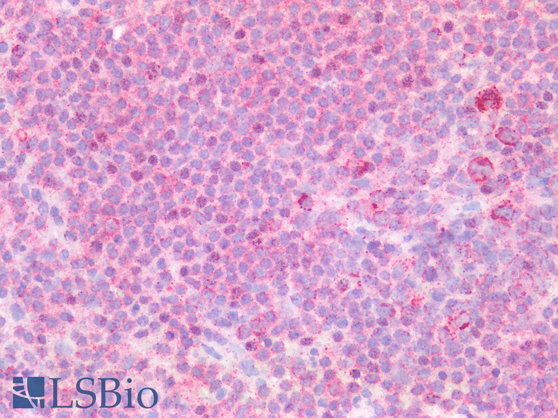 PathPlus™ SSBP1 / mtSSB Antibody