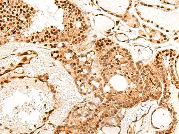 Polyclonal Rabbit anti-Human PDCD4 Antibody (IHC, WB)